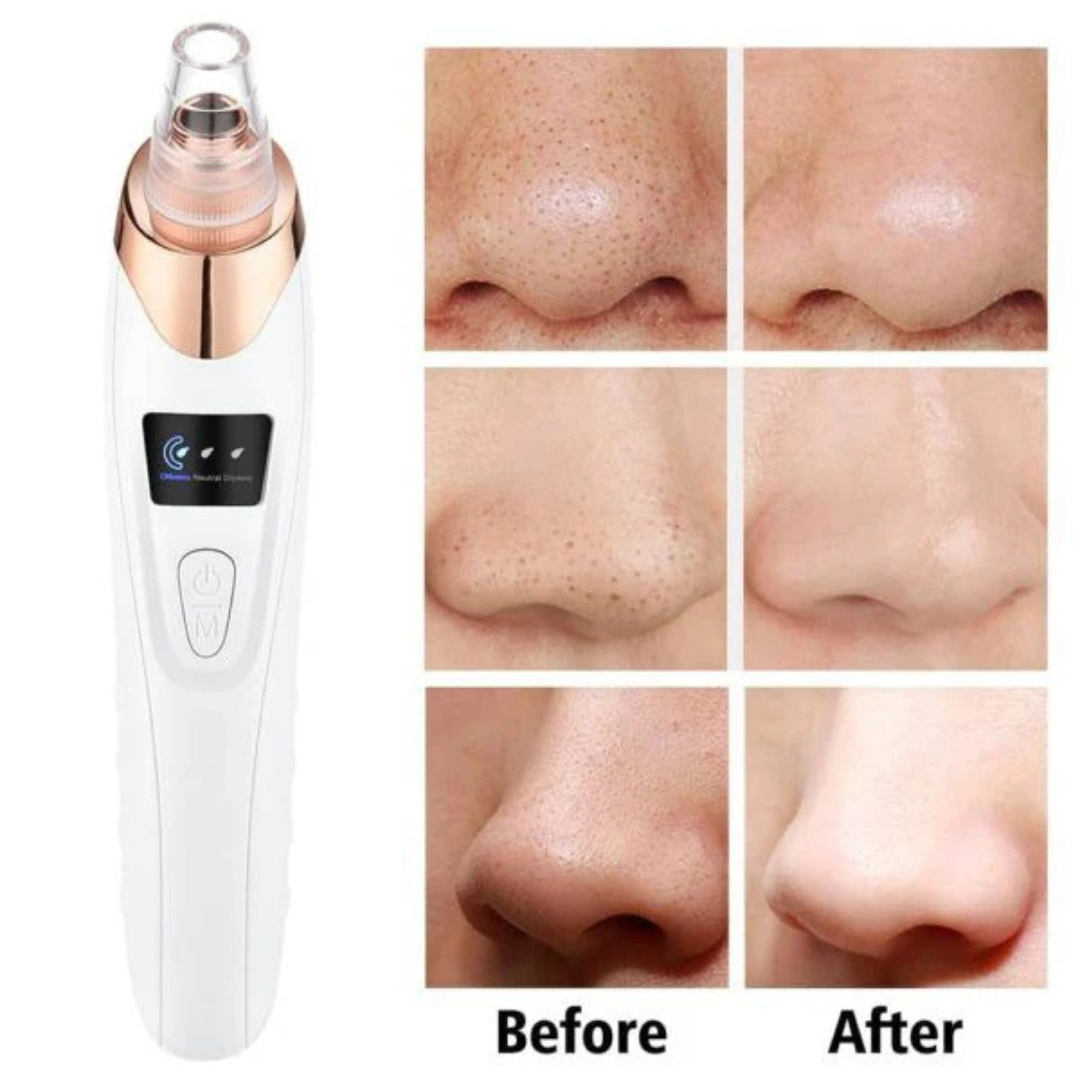 Face Vacuum Suction Blackhead Remover Machine | Deep Cleansing For Nose & Face