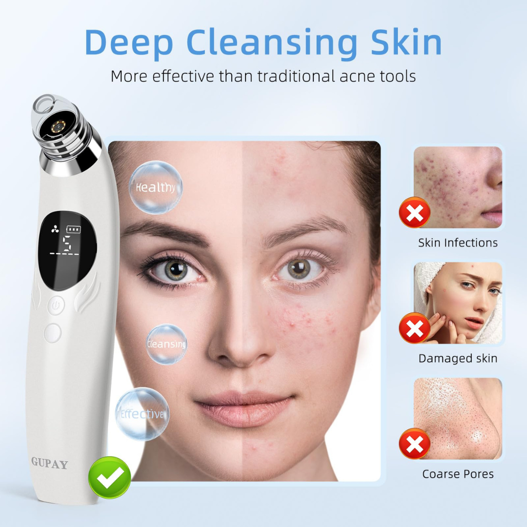 Face Vacuum Suction Blackhead Remover Machine | Deep Cleansing For Nose & Face