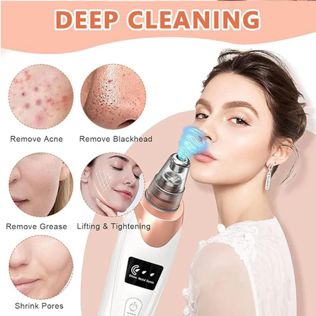 Face Vacuum Suction Blackhead Remover Machine | Deep Cleansing For Nose & Face